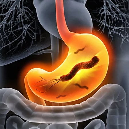 Анализ на Хеликобактер Пилори Алматы